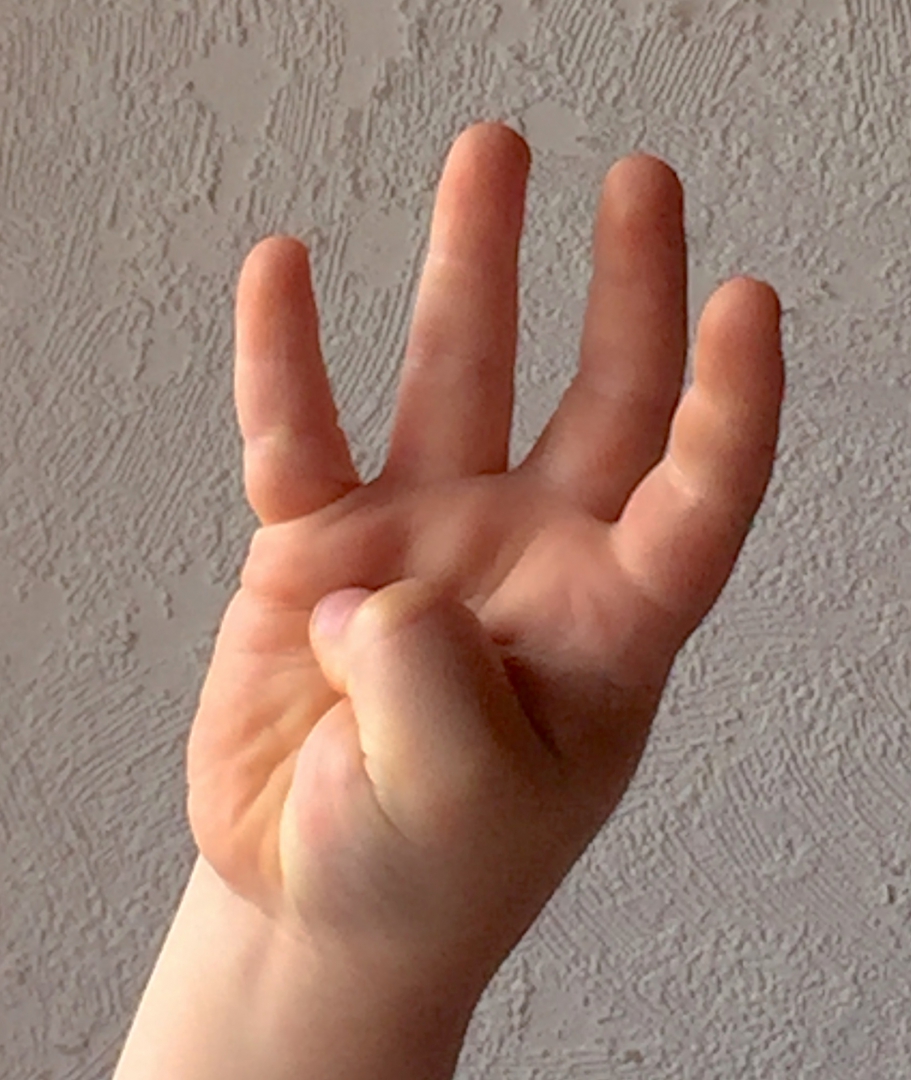 Foto einer Kinderhand. Der Daumen zeigt in die Handinnenfläche. Alle anderen Finger sind ausgestreckt.