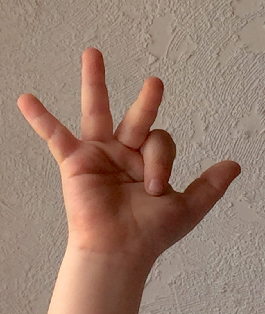 Foto einer Kinderhand. Der Zeigefinger zeigt in die Handinnenfläche. Alle anderen Finger sind ausgestreckt.