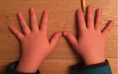 Foto von zwei Kinderhänden, die ausgestreckt auf einem Tisch liegen. Ein Bleistift liegt an der rechten Hand zwischen Zeige- und Mittelfinger.