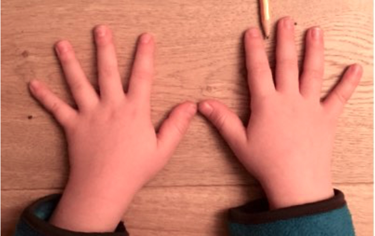 Foto von zwei Kinderhänden. An der rechten Hand liegt zwischen dem Zeige- und Mittelfinger ein Stift.